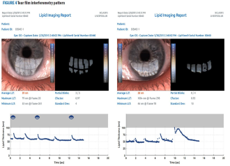 Working With Optometrists