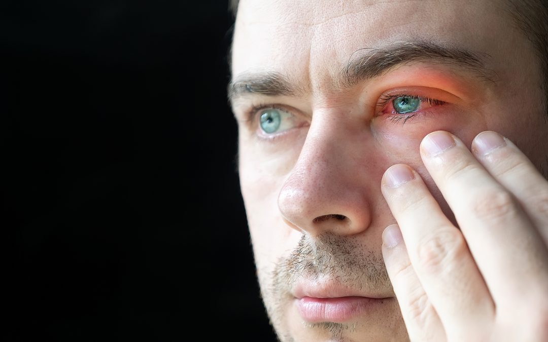 Dry Eye or Allergic Eye Disease